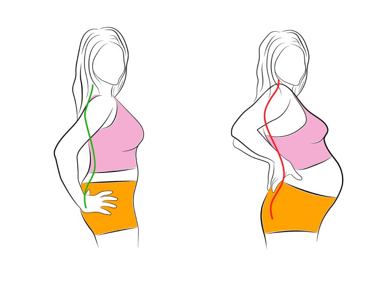Боли в спине при беременности — блог медицинского центра ОН Клиник