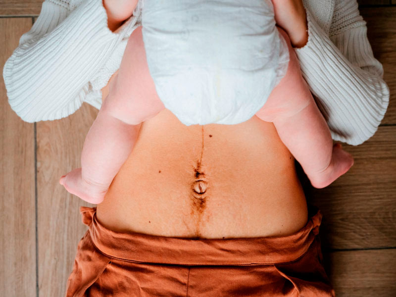 Как убрать живот после родов – советы по эффективному и безопасному похудению