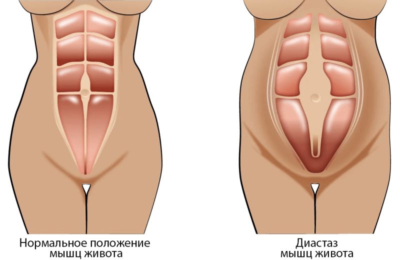 Особенности женского телосложения