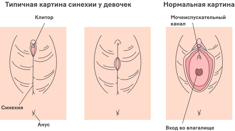 Как проявляется заболевание